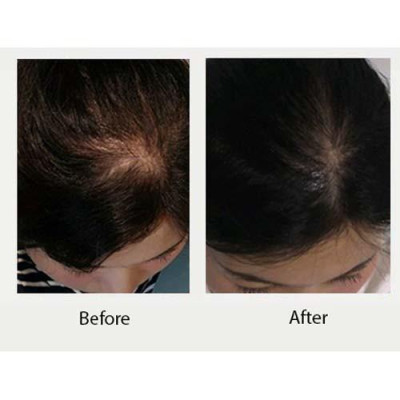 Dầu gội gừng trắng ngăn rụng và kích mọc tóc Weilaiya Ginger Shampoo 400ml