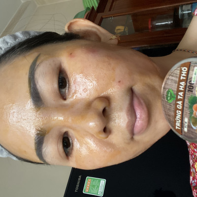 TRỨNG GÀ TA HẠ THỔ THUỐC BẮC MẸ KEN-CHAI 100ML