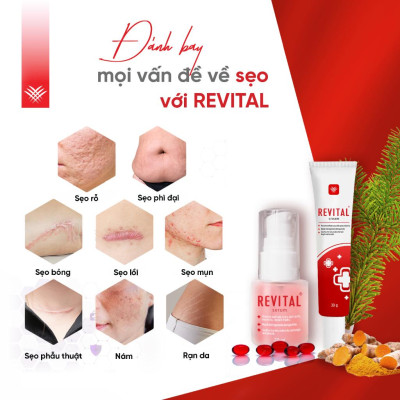 COMBO 2 Tuýp Kem Mờ Sẹo REVITAL 30g, Hỗ Trợ Làm Mờ Sẹo, Giúp Dịu Da Cho Làn Da Sáng Mịn, Hồng Hào