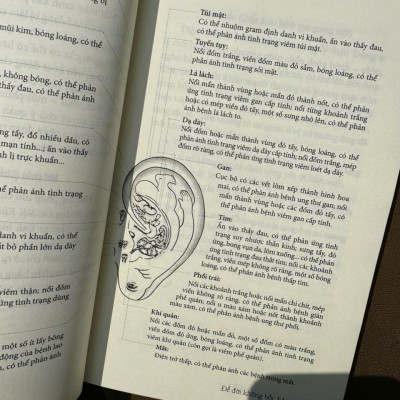 ĐỂ ĐỜI KHÔNG BỐC HỎA - Đông Đồng - Mỹ Linh dịch - Huy Hoàng 