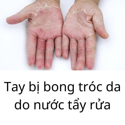 [Mua 3 Tặng 2] Bộ 3 Đôi Găng Tay Cao Su MJ Có Móc Thương Hiệu BEIGL Có Móc Đủ Kích Cỡ