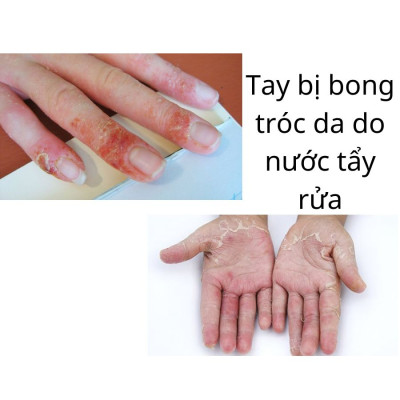 [Mua 3 Tặng 2] Bộ 3 Đôi Găng Tay Cao Su MJ Có Móc Thương Hiệu BEIGL Có Móc Đủ Kích Cỡ