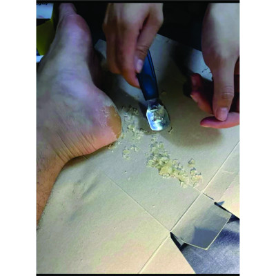 Chà Gót Chân, Máy Mài Gót Chân Tẩy Tế Bào Chết Sạc Điện 2 Tốc Độ + Tặng Bộ Dụng Cụ Chà Gót Chân 10 Món Cao Cấp Chính Hãng