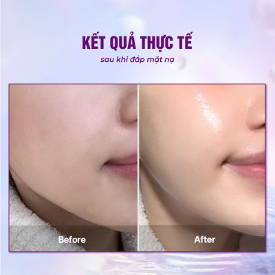 Mặt nạ sinh học BESKINATY Hydro Bio Mask cấp ẩm chuyên sâu cho da Hàn Quốc