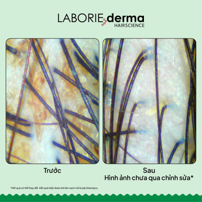 Dầu gội hỗ trợ cân bằng hệ vi sinh da đầu LABORIE derma Scalp Shampoo 250ml