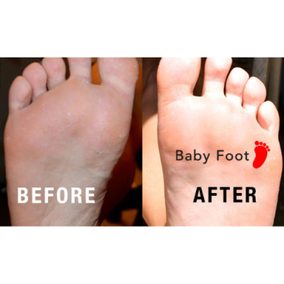 MẶT NẠ Ủ CHÂN BABY FOOT CHO DA GÓT CHÂN KHÔ VÀ NỨT NẺ NHẬT BẢN
