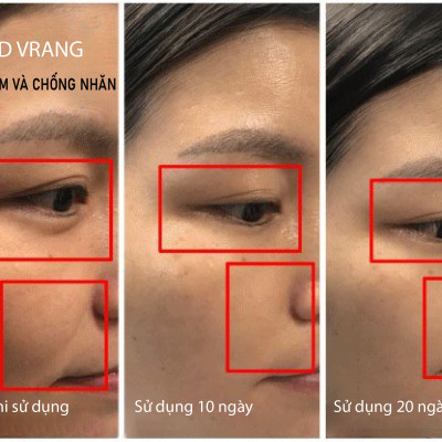 Máy Massage Cầm Tay Chăm Sóc Da Mặt Led Vrang quà tặng hội chị em nhân ngày 20/10