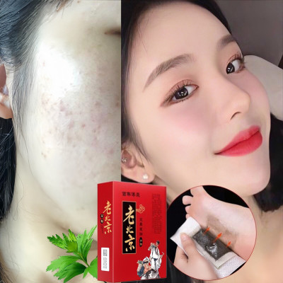 Hộp 50 Miếng Dán Thải Độc Bàn Chân Ngải Cứu Bắc Kinh - An Toàn,Hiệu Qủa 6-8 Tiếng