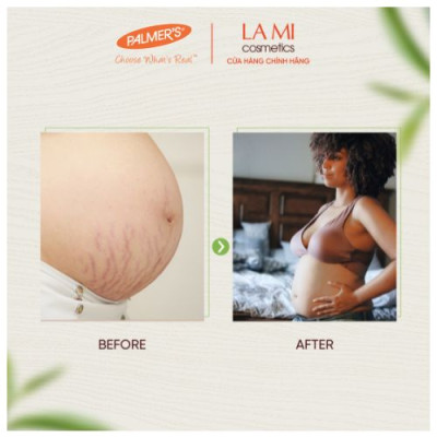Bơ dưỡng ẩm rạn da cuối thai kỳ Palmer
