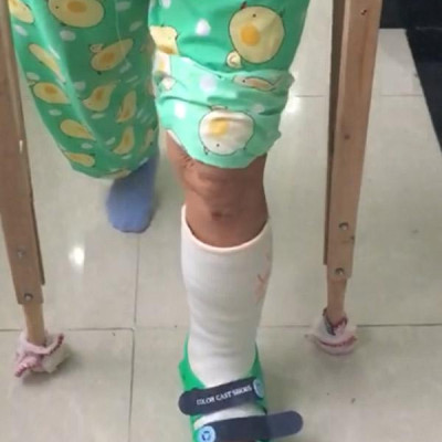 Giày bảo vệ chân BL Tech size L (Xanh dương) dùng cho chân đang chấn thương hoặc bó bột